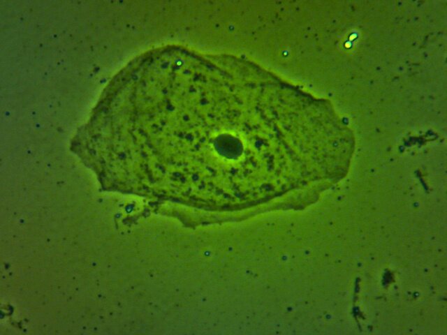 epithelial cell 01.jpg